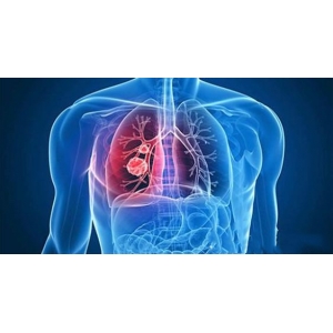 智慧医疗：人工智能+生命科学结合了什么？